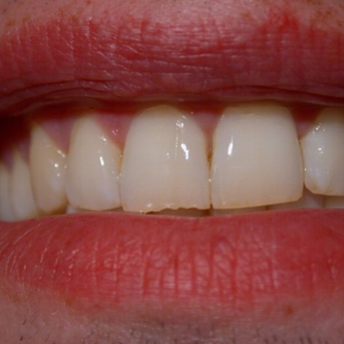 Desconfie do sorriso Imediato
